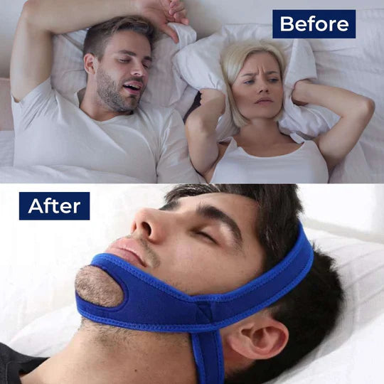 Full Head Chin Strap for Snoring Relief | Sleep Apnea...