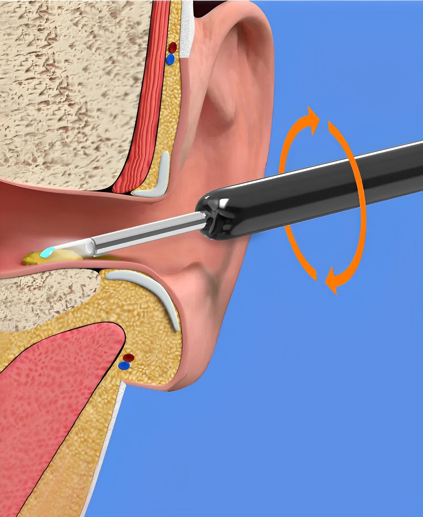 EarBit 3000 - Ear Cleaning Tool with a Camera