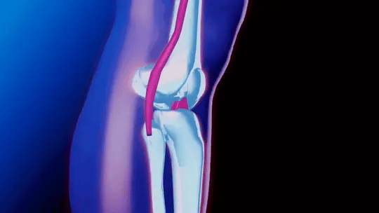 Knee Support with Adjustable Compression | for Pain...