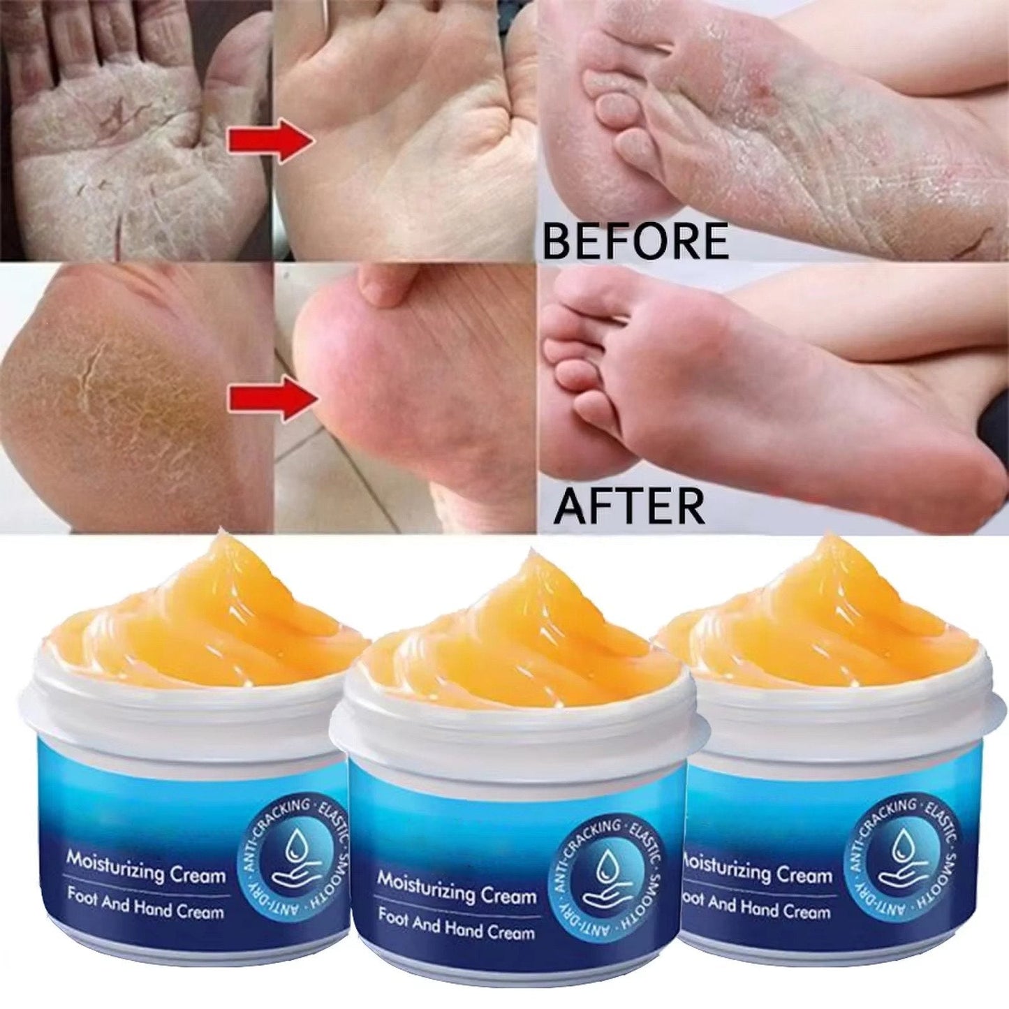 Cracked Foot Heel Treatment