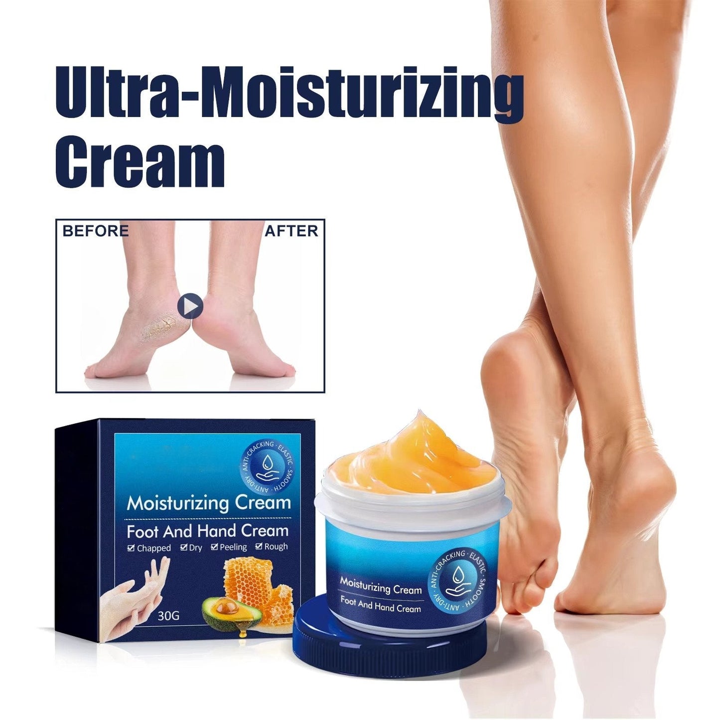 Cracked Foot Heel Treatment